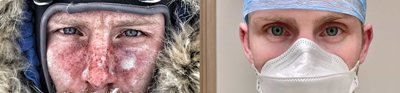 Two images of Dr Alex Brazier side by side. One of the images shows him on an expedition in Antarctica while the other one shows him in PPE while working in ICU.